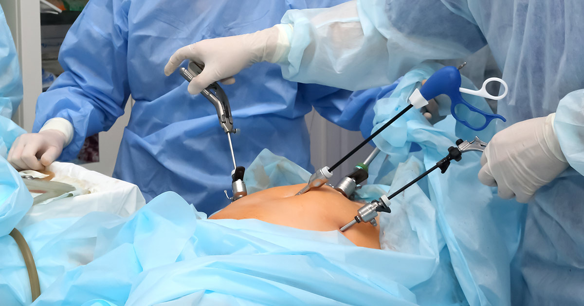 laparoscopy